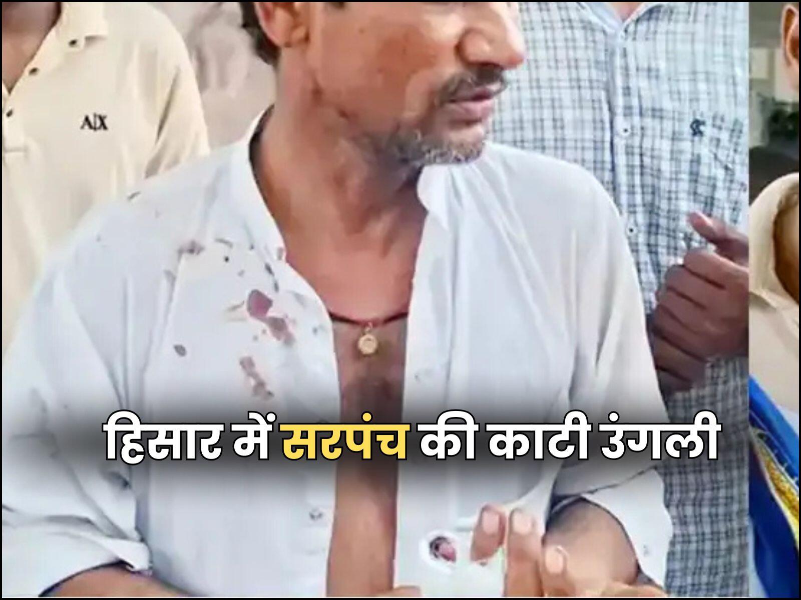 हिसार में सरपंच की काटी उंगली