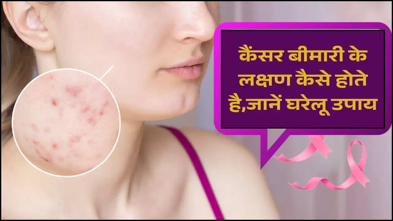 कैंसर बीमारी के लक्षण कैसे होते है,जानें घरेलू उपाय